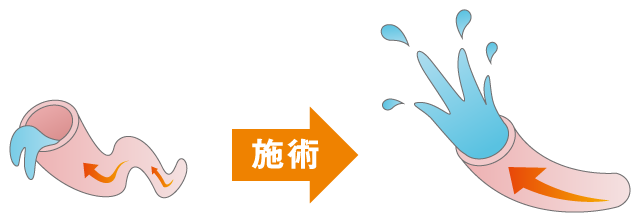 血管の弾力が戻ります