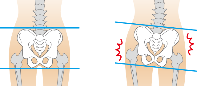 体がゆがみむと、脳はストレスと感じる