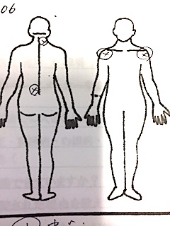 左腰・右首の痛み　両肩の挙高
