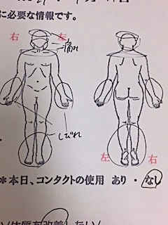 頭痛、手足のしびれ